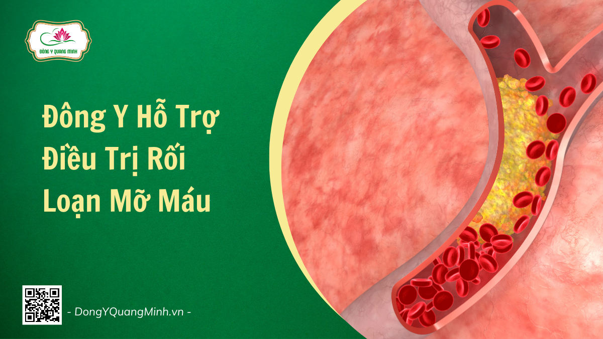 Đông Y Hỗ Trợ Điều Trị Rối Loạn Mỡ Máu