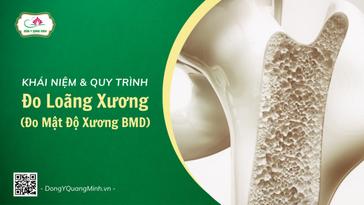 Đo Loãng Xương (Đo Mật Độ Xương BMD) Là Gì?