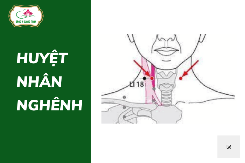 huyệt Nhân Nghênh