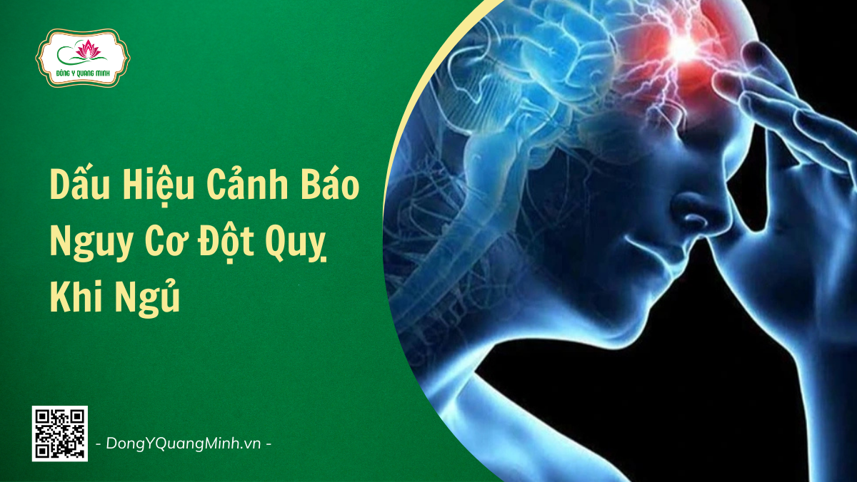 Dấu Hiệu Cảnh Báo Nguy Cơ Đột Quỵ Khi Ngủ